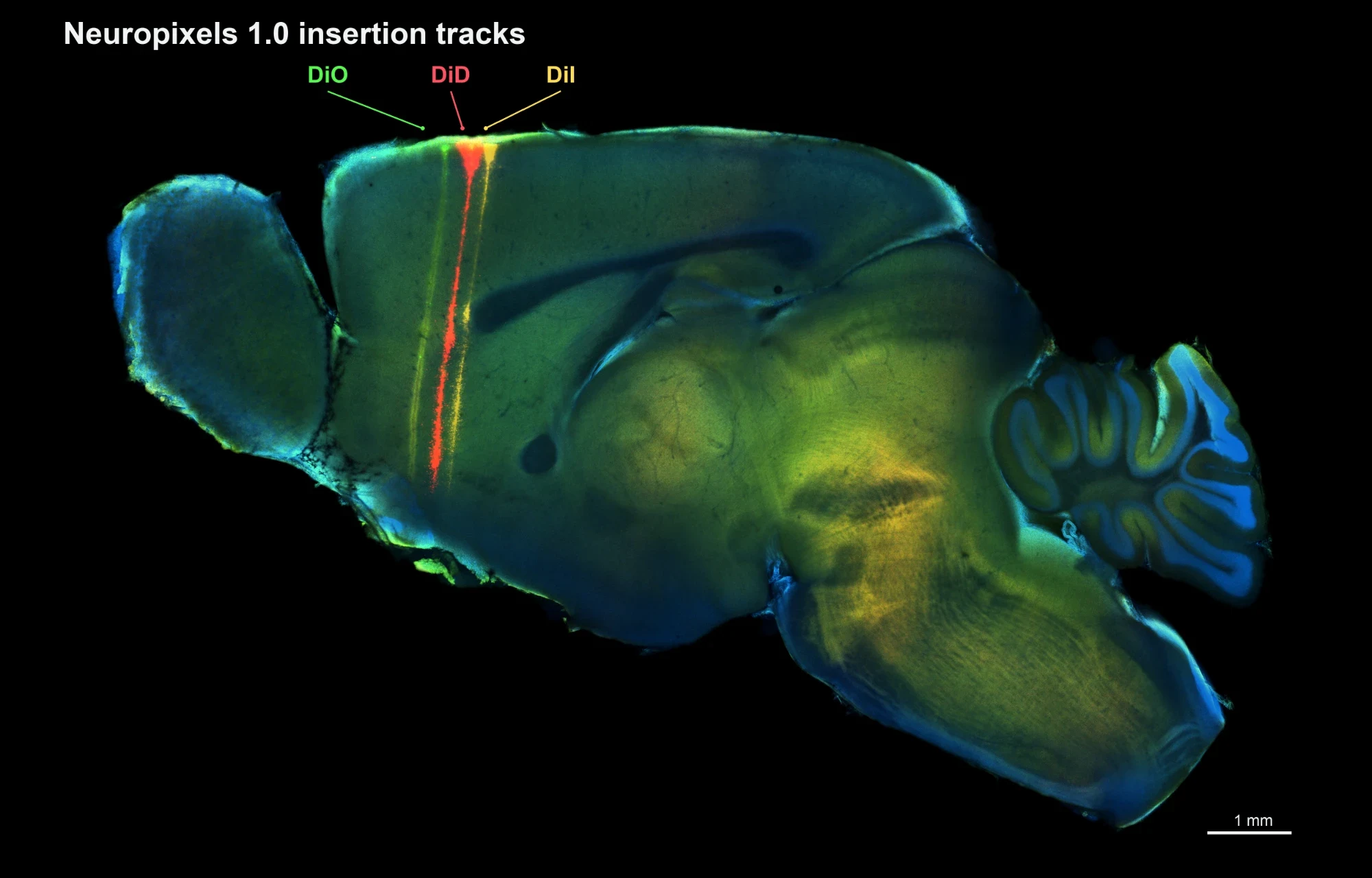 Sagittal section of a mouse brain showing three parallel Neuropixels 1.0 probe tracks labeled green (DiO), red (DiD), and yellow (DiI) descending through the frontal cortex.